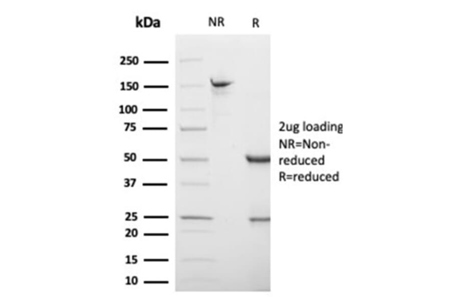 SDS-PAGE - Anti-S100 beta Antibody [S100B/4138] (A277784) - Antibodies.com