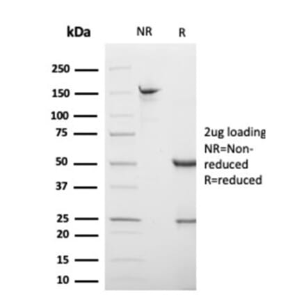 SDS-PAGE - Anti-S100 beta Antibody [S100B/4138] (A277784) - Antibodies.com
