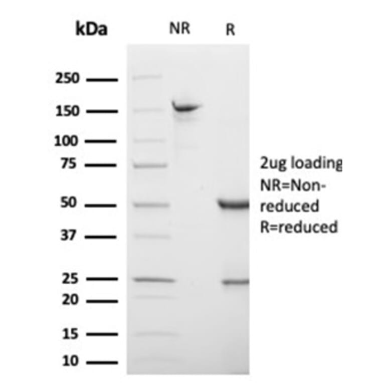 SDS-PAGE - Anti-S100 beta Antibody [S100B/4138] (A277784) - Antibodies.com
