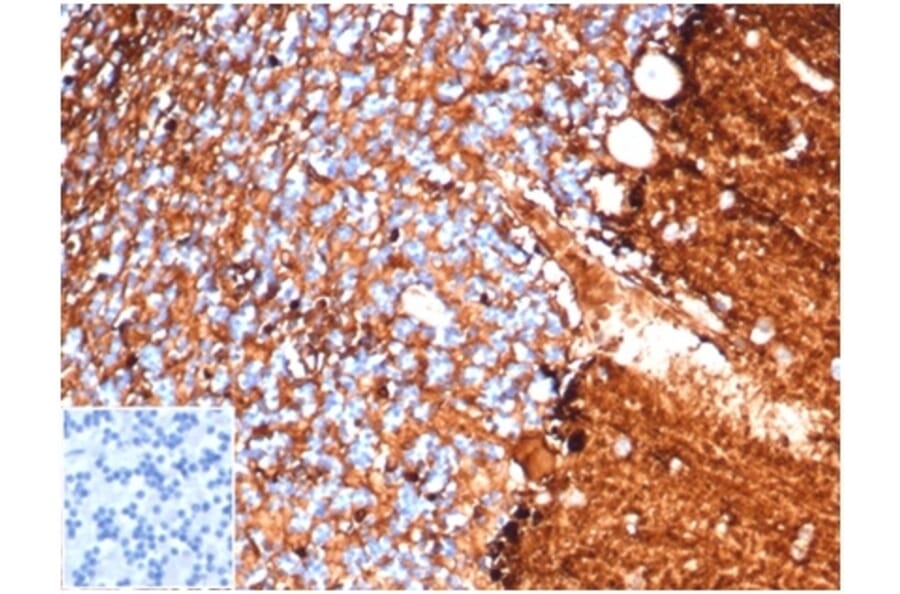 Immunohistochemistry - Anti-S100 beta Antibody [S100B/4138] (A277784) - Antibodies.com