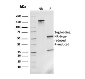 SDS-PAGE - Anti-MCP2 Antibody [CCL8/3311] (A277785) - Antibodies.com