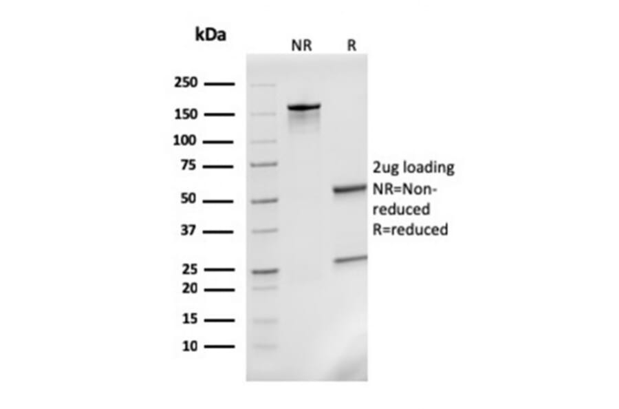 SDS-PAGE - Anti-MCP2 Antibody [CCL8/3311] (A277785) - Antibodies.com