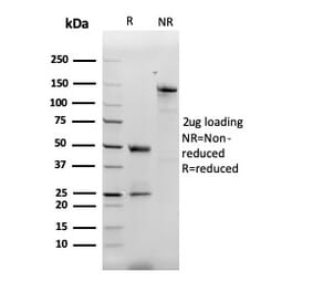 SDS-PAGE - Anti-MCP2 Antibody [CCL8/3312] (A277786) - Antibodies.com
