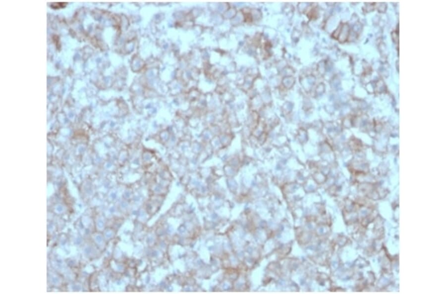 Immunohistochemistry - Anti-MCP2 Antibody [CCL8/3312] (A277786) - Antibodies.com