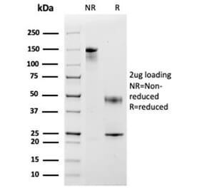 SDS-PAGE - Anti-MCP2 Antibody [CCL8/3683] (A277787) - Antibodies.com