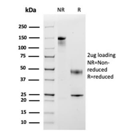 SDS-PAGE - Anti-MCP2 Antibody [CCL8/3683] (A277787) - Antibodies.com