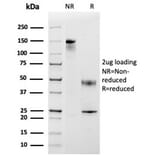 SDS-PAGE - Anti-MCP2 Antibody [CCL8/3683] (A277787) - Antibodies.com