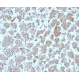 Immunohistochemistry - Anti-MCP2 Antibody [CCL8/3683] (A277787) - Antibodies.com