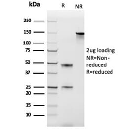 SDS-PAGE - Anti-MCP2 Antibody [CCL8/3686] (A277788) - Antibodies.com