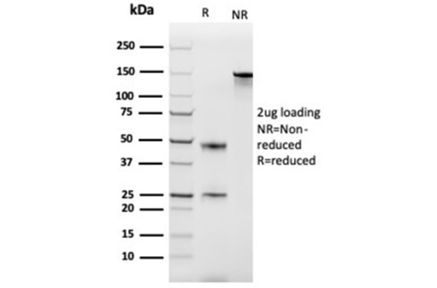 SDS-PAGE - Anti-MCP2 Antibody [CCL8/3686] (A277788) - Antibodies.com