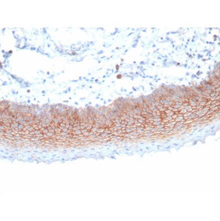 Immunohistochemistry - Anti-Syndecan 1 Antibody [SDC1/7180] (A277789) - Antibodies.com
