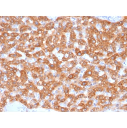 Immunohistochemistry - Anti-SDHB Antibody [SDHB/2126] (A277790) - Antibodies.com