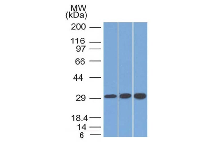 Western Blot - Anti-SDHB Antibody [SDHB/2126] (A277790) - Antibodies.com