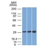 Western Blot - Anti-SDHB Antibody [SDHB/2126] (A277790) - Antibodies.com