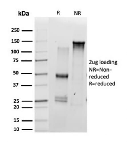 SDS-PAGE analysis of Anti-SCXA Antibody [PCRP-SCXA-1D2] under non-reduced and reduced conditions; showing intact IgG and intact heavy and light chains, respectively. SDS-PAGE analysis confirms the integrity and purity of the antibody.