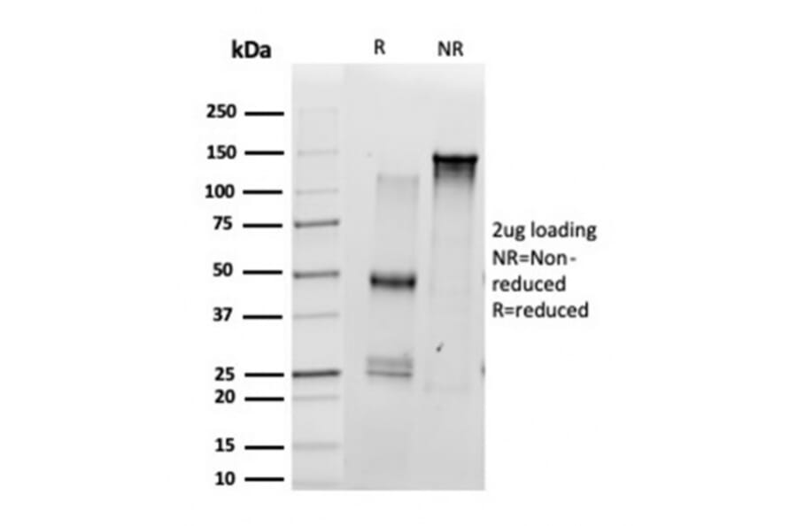 SDS-PAGE - Anti-SCXA Antibody [PCRP-SCXA-1D2] (A277791) - Antibodies.com