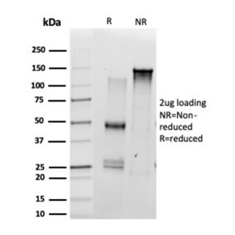 SDS-PAGE - Anti-SCXA Antibody [PCRP-SCXA-1D2] (A277791) - Antibodies.com