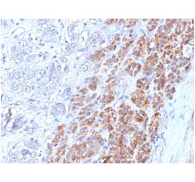 Immunohistochemistry - Anti-IL-25 Antibody [IL25/625] (A277793) - Antibodies.com