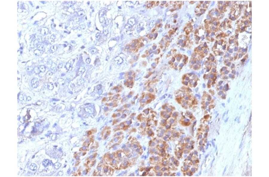Immunohistochemistry - Anti-IL-25 Antibody [IL25/625] (A277793) - Antibodies.com