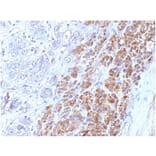 Immunohistochemistry - Anti-IL-25 Antibody [IL25/625] (A277793) - Antibodies.com