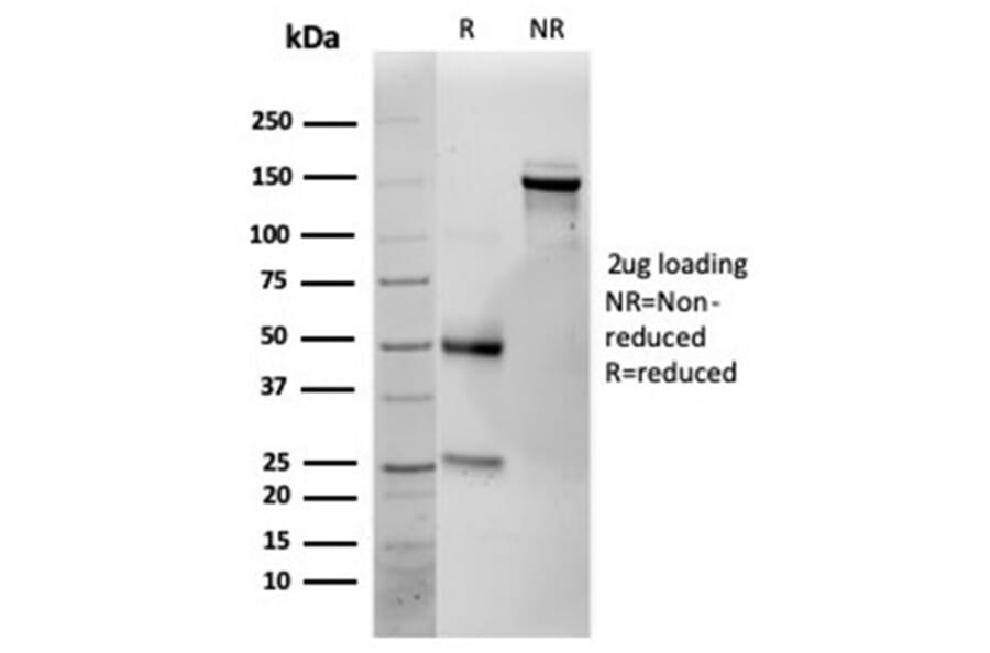 SDS-PAGE - Anti-IL-25 Antibody [IL25/625] (A277793) - Antibodies.com