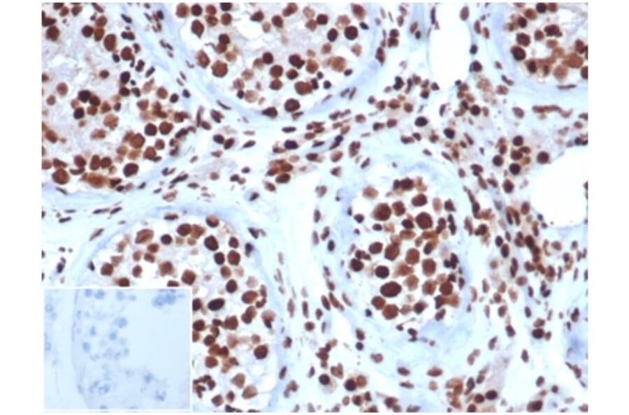 Immunohistochemistry - Anti-SNF5 Antibody [SMARCB1/3984] (A277794) - Antibodies.com