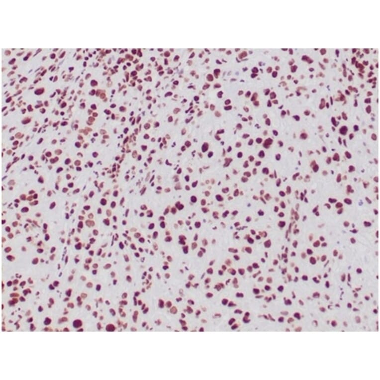 Immunohistochemistry - Anti-SNF5 Antibody [SMARCB1/3984] (A277794) - Antibodies.com