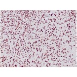 Immunohistochemistry - Anti-SNF5 Antibody [SMARCB1/3984] (A277794) - Antibodies.com