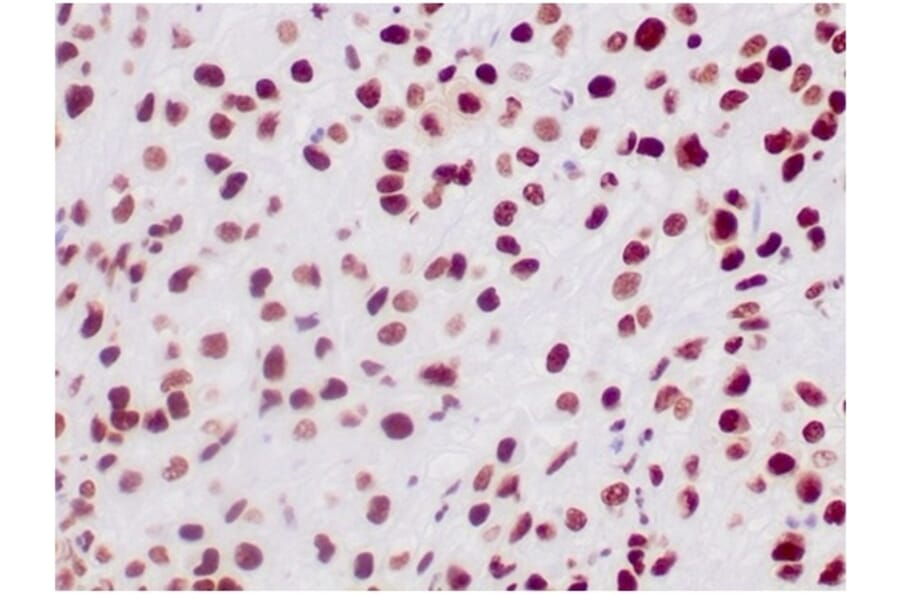 Immunohistochemistry - Anti-SNF5 Antibody [SMARCB1/3984] (A277794) - Antibodies.com
