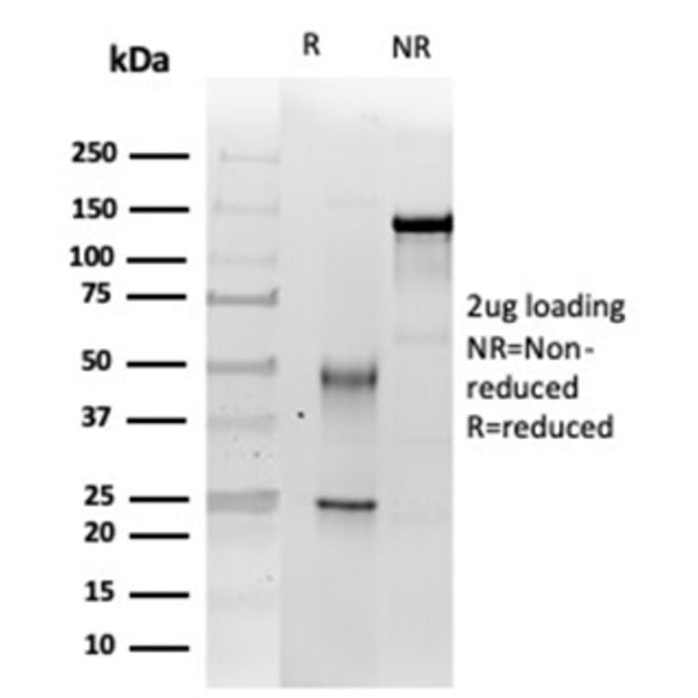 SDS-PAGE - Anti-SNF5 Antibody [SMARCB1/3984] (A277794) - Antibodies.com