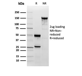 SDS-PAGE - Anti-Superoxide Dismutase 1 Antibody [SOD1/3923] (A277795) - Antibodies.com