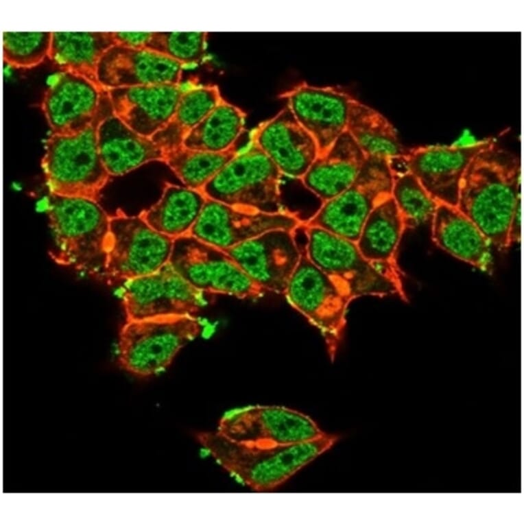 Immunofluorescence - Anti-Superoxide Dismutase 1 Antibody [SOD1/3923] (A277795) - Antibodies.com