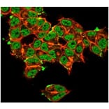 Immunofluorescence - Anti-Superoxide Dismutase 1 Antibody [SOD1/3923] (A277795) - Antibodies.com