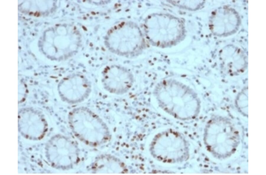 Immunohistochemistry - Anti-SOX4 Antibody [PCRP-SOX4-1D6] (A277796) - Antibodies.com
