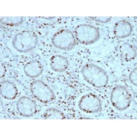 Immunohistochemistry - Anti-SOX4 Antibody [PCRP-SOX4-1D6] (A277796) - Antibodies.com