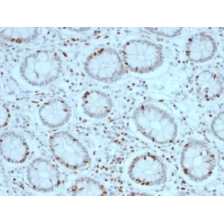 Immunohistochemistry - Anti-SOX4 Antibody [PCRP-SOX4-1D6] (A277796) - Antibodies.com