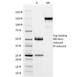 SDS-PAGE - Anti-SOX9 Antibody [PCRP-SOX9-1E5] (A277797) - Antibodies.com