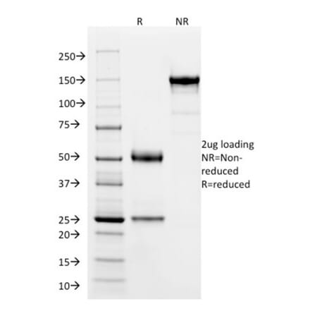 SDS-PAGE - Anti-SOX9 Antibody [PCRP-SOX9-1E5] (A277797) - Antibodies.com