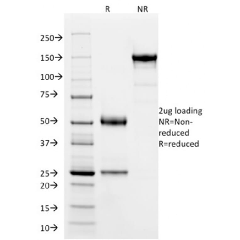 SDS-PAGE - Anti-SOX9 Antibody [PCRP-SOX9-1E5] (A277797) - Antibodies.com