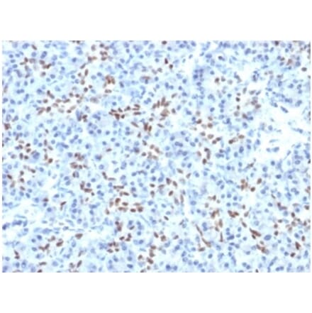 Immunohistochemistry - Anti-SOX9 Antibody [PCRP-SOX9-1A2] (A277798) - Antibodies.com