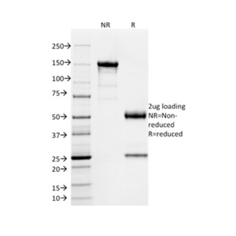 SDS-PAGE - Anti-SOX9 Antibody [PCRP-SOX9-1A2] (A277798) - Antibodies.com