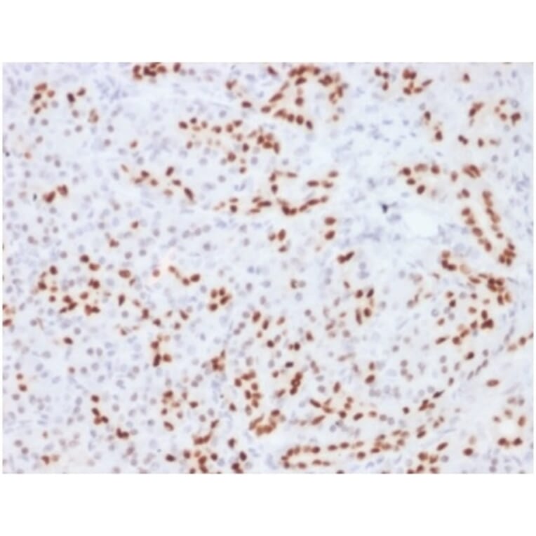 Immunohistochemistry - Anti-SOX9 Antibody [SOX9/2104] (A277799) - Antibodies.com