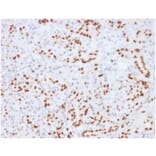 Immunohistochemistry - Anti-SOX9 Antibody [SOX9/2104] (A277799) - Antibodies.com