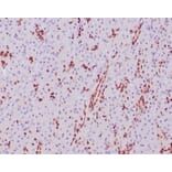 Immunohistochemistry - Anti-SOX9 Antibody [SOX9/2387] (A277800) - Antibodies.com