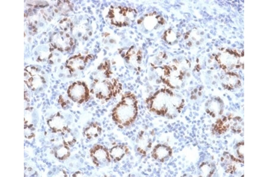 Immunohistochemistry - Anti-SOX9 Antibody [SOX9/2387] (A277800) - Antibodies.com