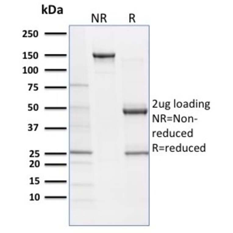 SDS-PAGE - Anti-SOX9 Antibody [SOX9/2387] (A277800) - Antibodies.com