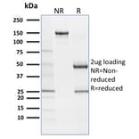 SDS-PAGE - Anti-SOX9 Antibody [SOX9/2387] (A277800) - Antibodies.com