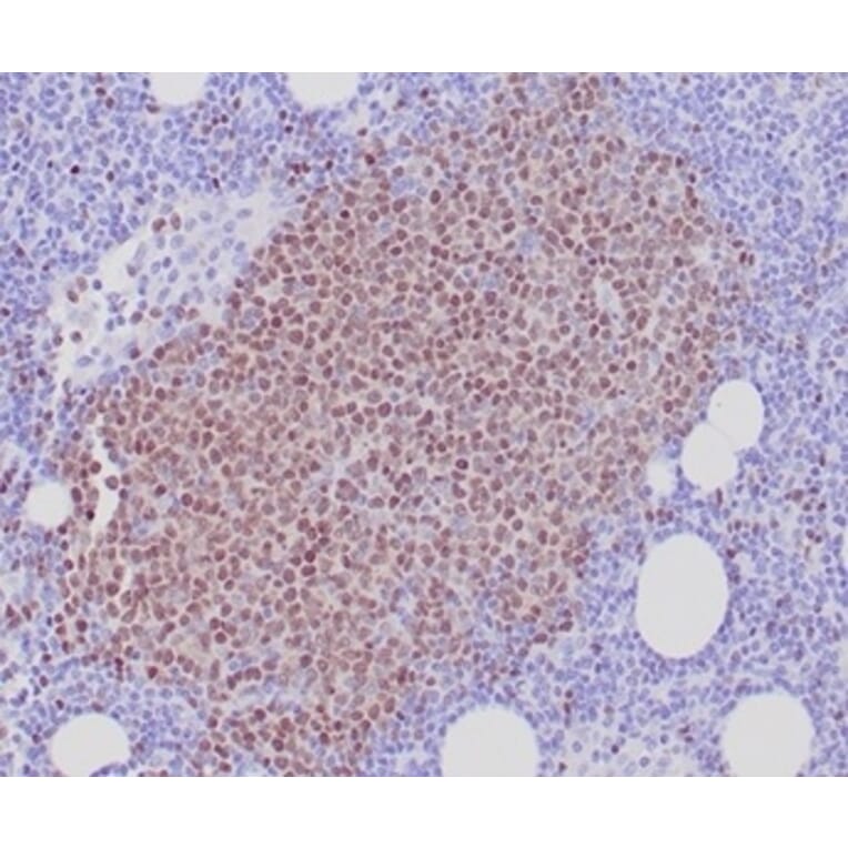 Immunohistochemistry - Anti-SOX11 Antibody [SOX11/7236] (A277801) - Antibodies.com