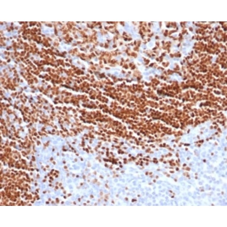 Immunohistochemistry - Anti-SOX11 Antibody [SOX11/7236] (A277801) - Antibodies.com