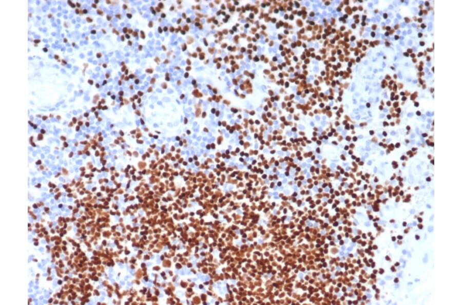 Immunohistochemistry - Anti-SOX11 Antibody [SOX11/7236] (A277801) - Antibodies.com